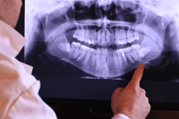 Best Broken or Chipped Tooth Repair in Pandora, OH